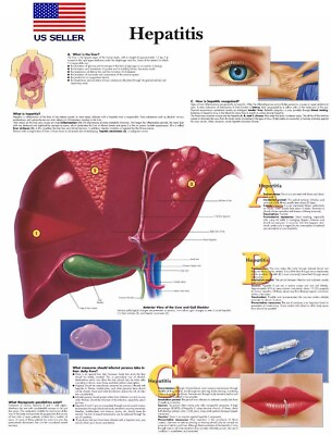 #ad Hepatitis Poster Anatomical Reference Poster Liver Poster Education Poster $11.99