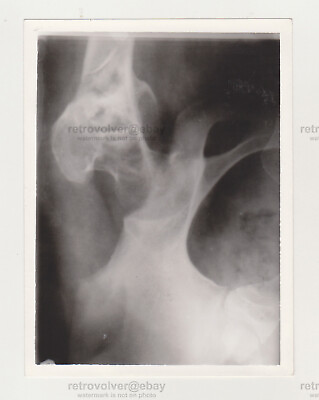 #ad X ray Photo Bone Skeleton Human Unusual Weird Odd Abstract Snapshot Photo $14.99