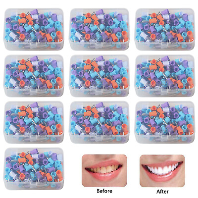 #ad 100 1000 Pcs Mixed Colorful Dental Rubber Prophy Tooth Polisher Cup Polishing dn $89.98