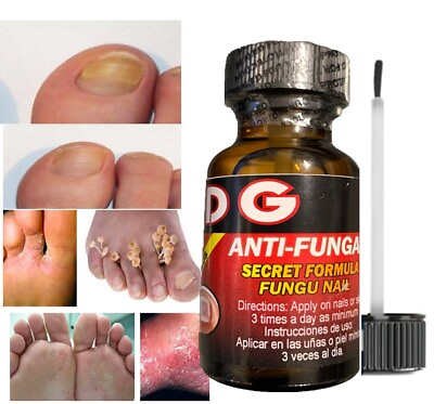 #ad NAIL TOE AND FOOT MAXIMUM STRENGTH ANTI FUNGAL Best nail Antifungal support $9.97