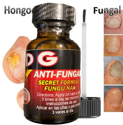 #ad Best nail Fungal SUPPORT FAST BEST PRODUCT ZANA NAILS QUICK TOE hongo $10.99