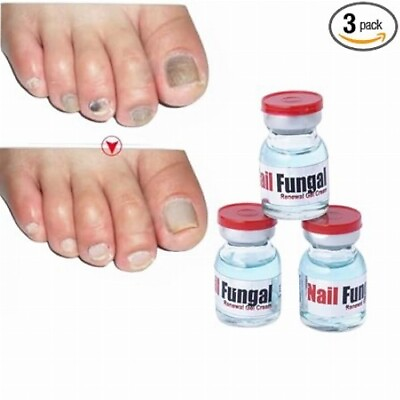 #ad AdiExpress Foot nail serum fungal Infection Best nail repair treatment liquid $22.66