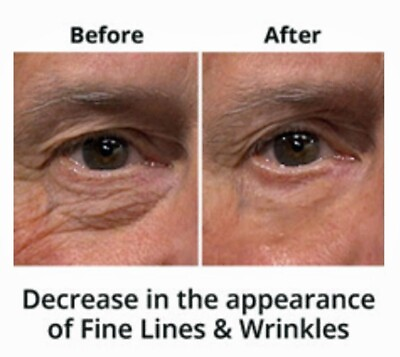 #ad Best 100% Under Eye Cream Remove Dark Circles Wrinkles Face Lines Puffy Eyes $9.99