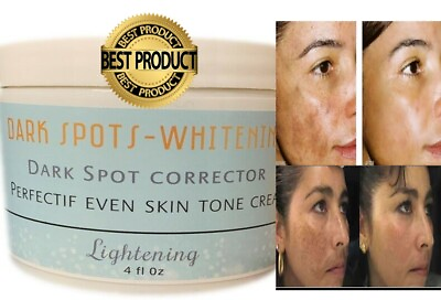 #ad Dark Skin White cream corrector light fade freckles face support Acne $12.15